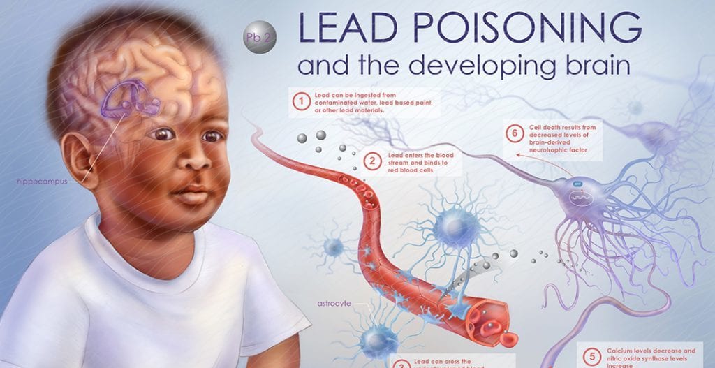 lead poisoning and the developing brain
